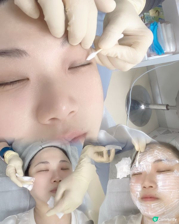 專業去疣之旅～