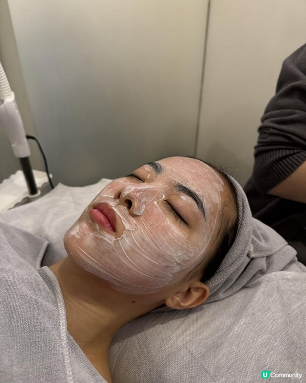 UBG暗瘡從本清療程