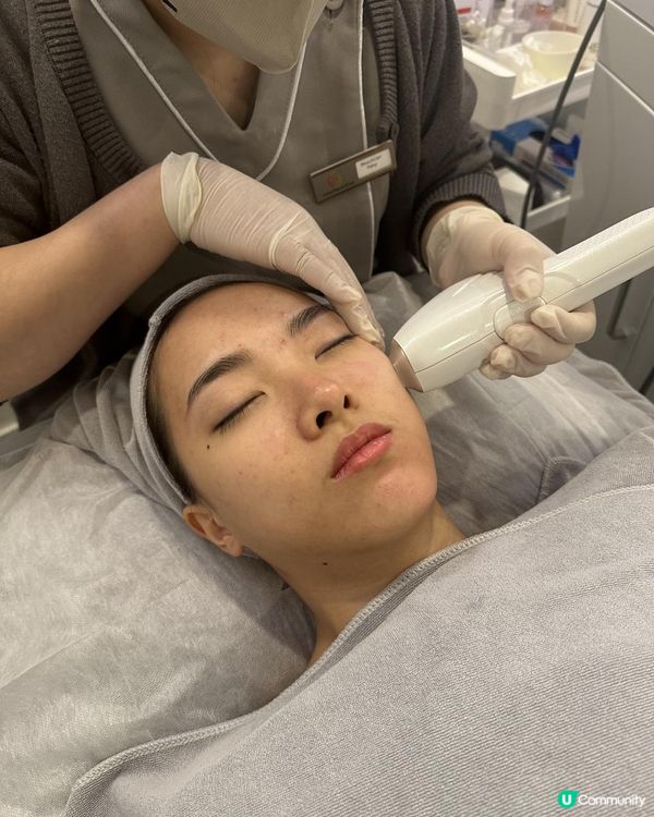 UBG暗瘡從本清療程