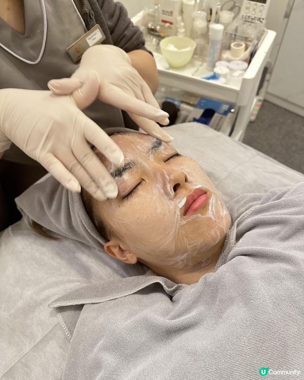 UBG暗瘡從本清療程