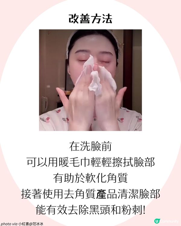 4大改善毛孔方法+毛孔粗大成因！了解毛孔類型才能對症下藥✨ 護膚好物推薦！