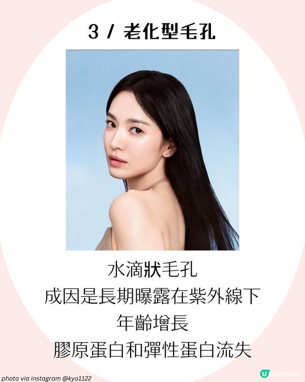 4大改善毛孔方法+毛孔粗大成因！了解毛孔類型才能對症下藥✨ 護膚好物推薦！