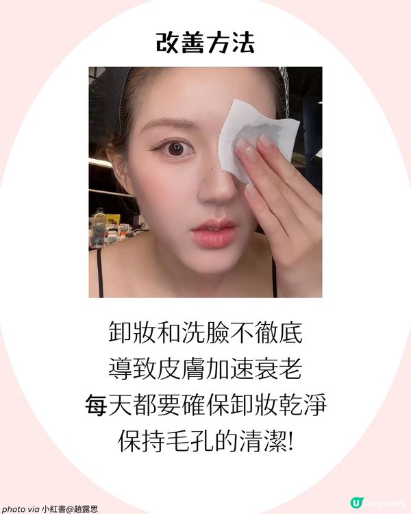 4大改善毛孔方法+毛孔粗大成因！了解毛孔類型才能對症下藥✨ 護膚好物推薦！