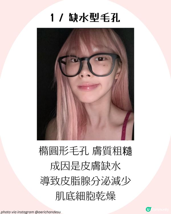4大改善毛孔方法+毛孔粗大成因！了解毛孔類型才能對症下藥✨ 護膚好物推薦！