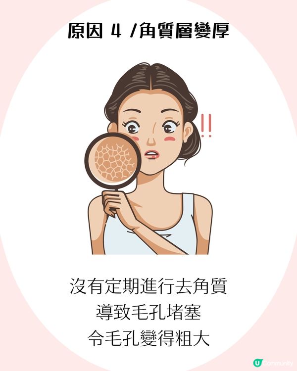 4大改善毛孔方法+毛孔粗大成因！了解毛孔類型才能對症下藥✨ 護膚好物推薦！