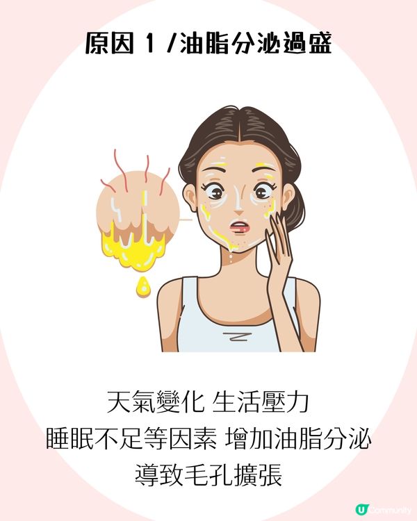 4大改善毛孔方法+毛孔粗大成因！了解毛孔類型才能對症下藥✨ 護膚好物推薦！