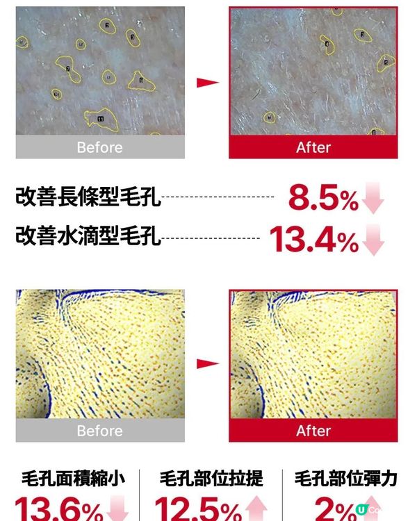 告別鬆弛！重返少女肌！韓國MediPeel胜肽膠原蛋白撕拉面膜，逆齡奇蹟，一撕即現！