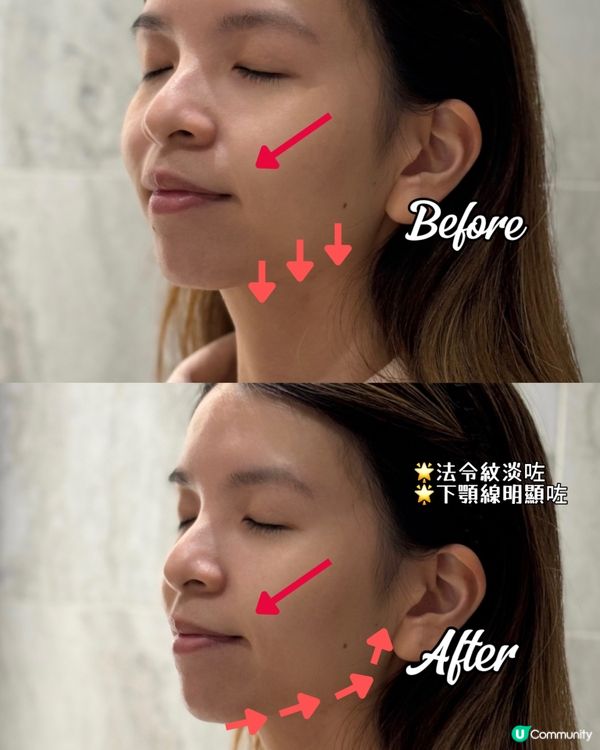 【MEDITHERAPY| V臉塑顏面膜 】