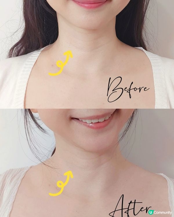 [文末優惠碼]細細個頸紋已經好深,胸口仲特別容易出粒粒,有暗...