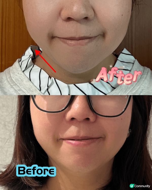 劉媽都愛美 💖皺紋OUT！