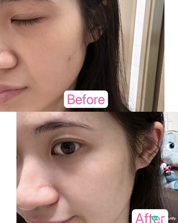 UNICHI小熊煙酰胺美白軟糖