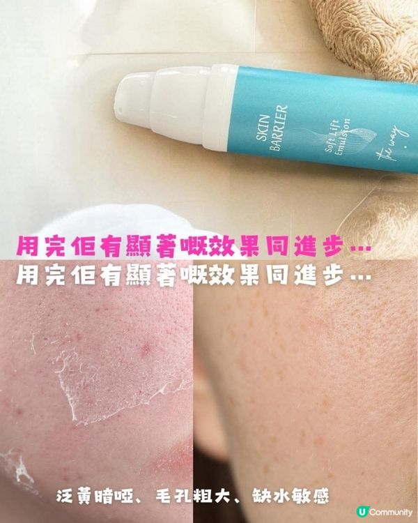 皮膚暗啞缺水敏感