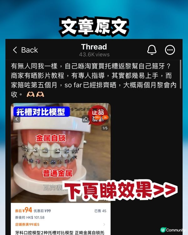 網民買入淘寶箍牙套裝😳⁉️實行自己箍牙:開心使用中🦷
