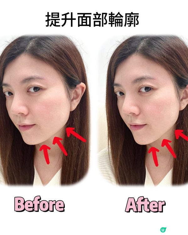 MEDITHERAPY V臉塑顏面膜