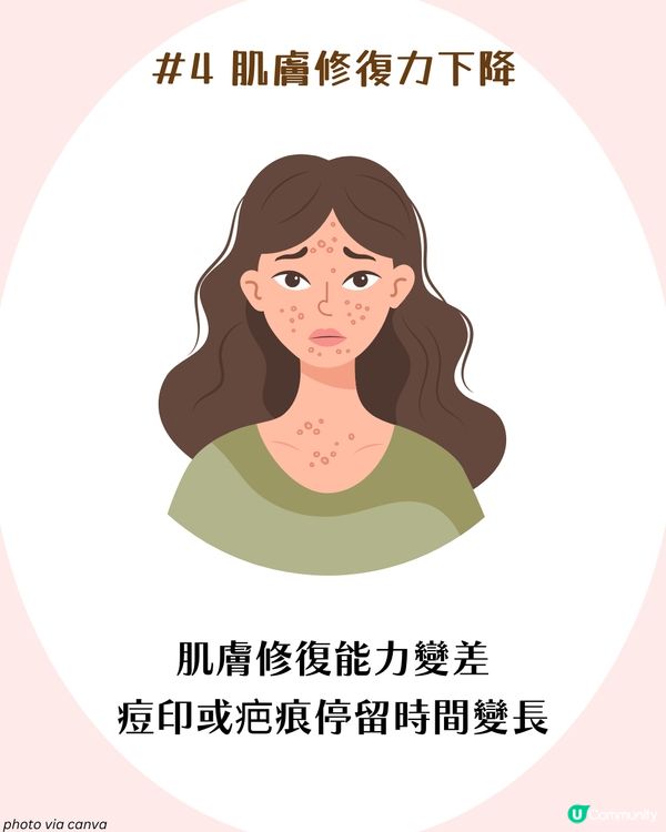 25+女生抗老護膚攻略✨6大抗衰老習慣🫵🏻 附肌膚初老徵狀檢查