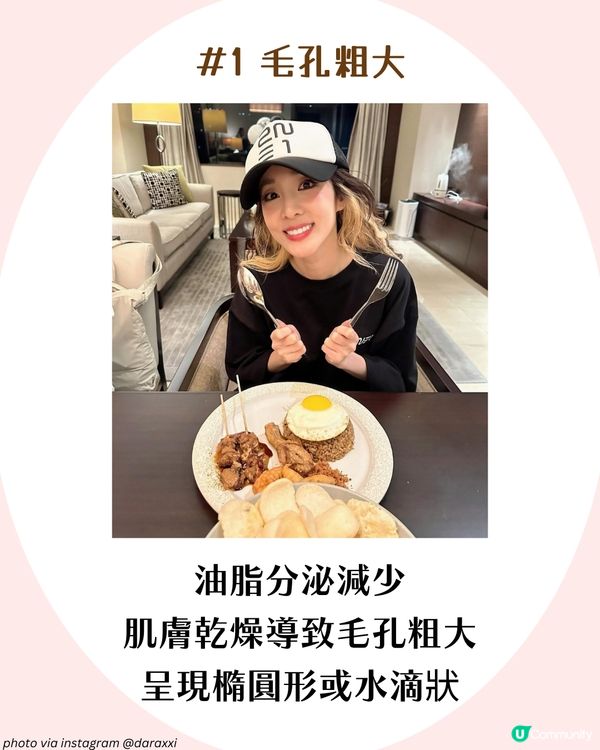 25+女生抗老護膚攻略✨6大抗衰老習慣🫵🏻 附肌膚初老徵狀檢查