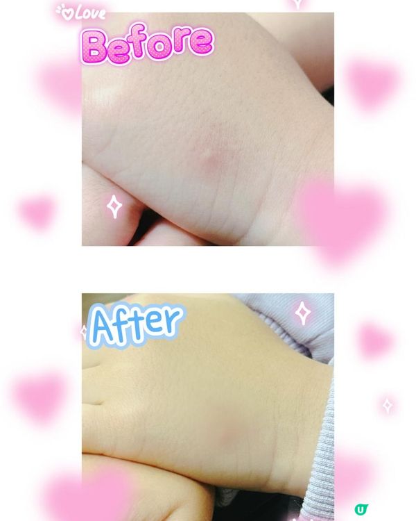 尚護健「甜橙即效止痕舒敏走珠」