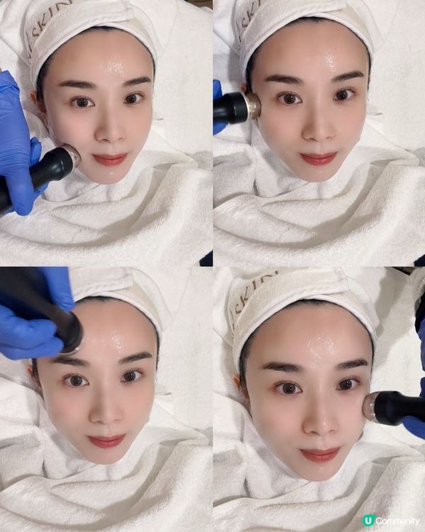 黑金鋼療程✨  包包面拜拜👋