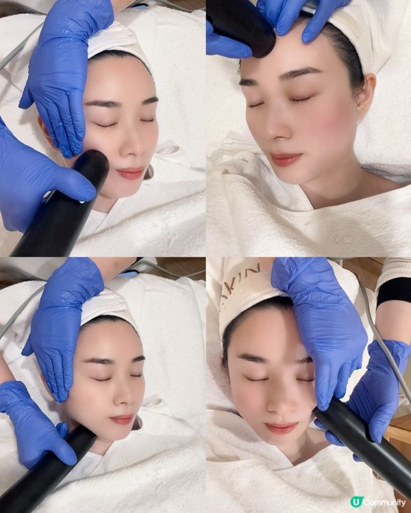 黑金鋼療程✨  包包面拜拜👋