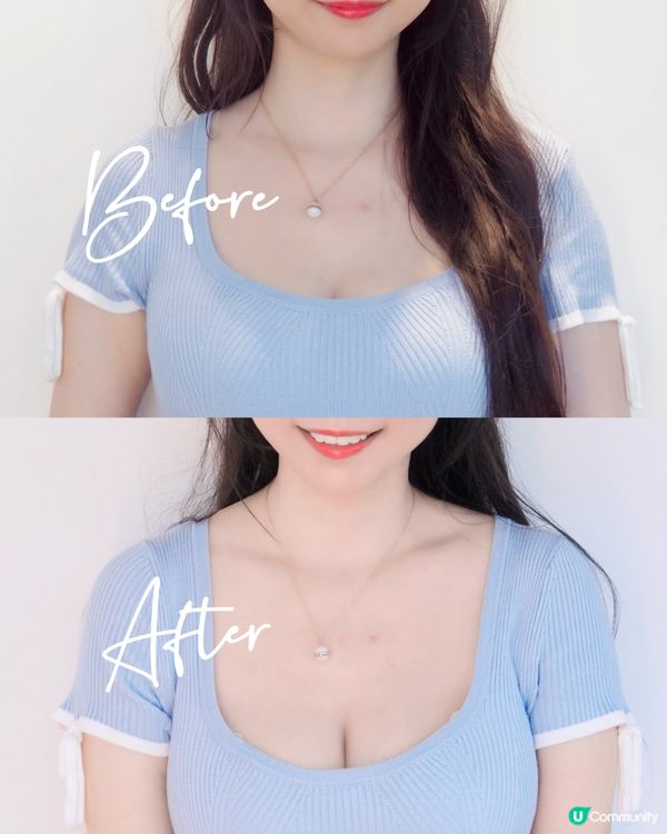 [🌟美胸磁頻緊緻塑形]成日都想胸部挺啲立體啲💗第一次去做美胸...