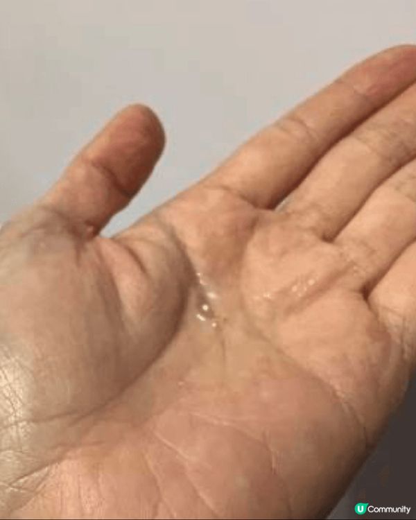 新年前諗住靚樣見人，去咗打第一次嘅黃金微針，打完治療師都提我...