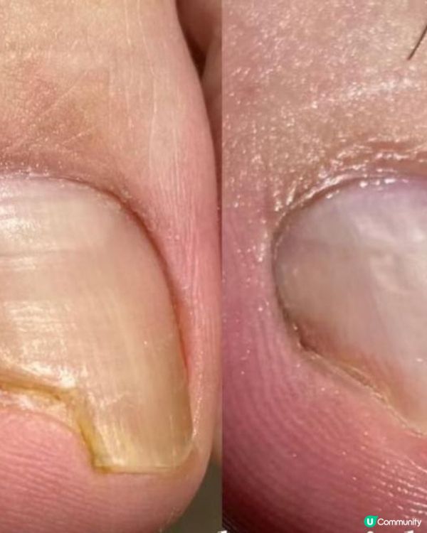 一齊踢爆！Future Medical 明逸醫療係黑店傳聞嘅4個真相