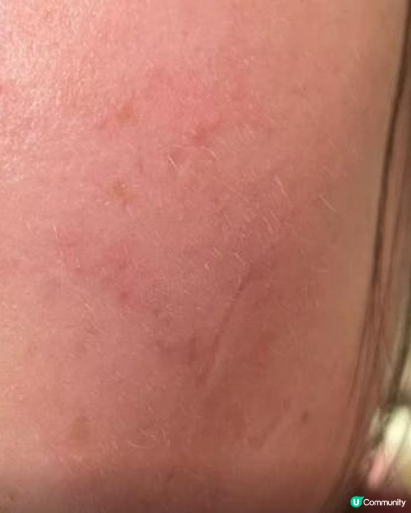 Future Medical明逸醫療係黑店？睇完呢篇你先決定！