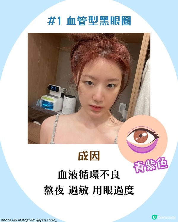 3大必學好習慣改善黑眼圈+好用眼霜推薦🫵🏻 附黑眼圈類型檢測
