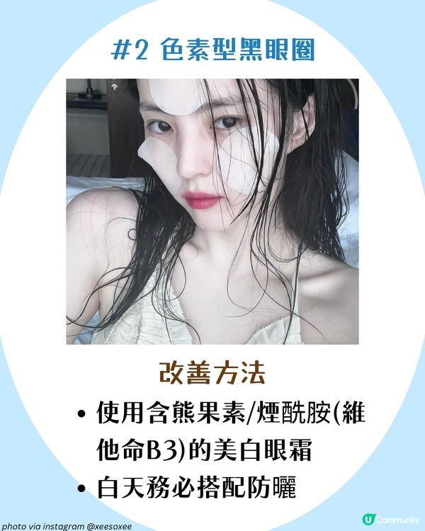 3大必學好習慣改善黑眼圈+好用眼霜推薦🫵🏻 附黑眼圈類型檢測