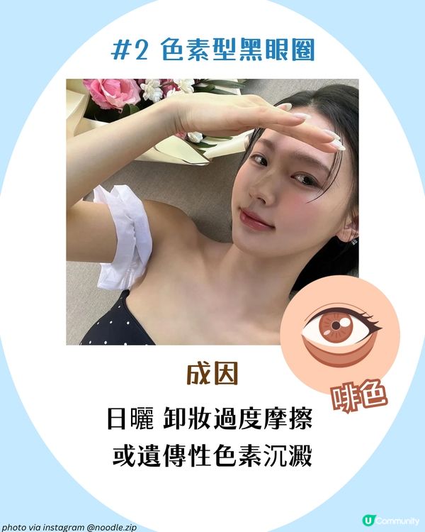 3大必學好習慣改善黑眼圈+好用眼霜推薦🫵🏻 附黑眼圈類型檢測