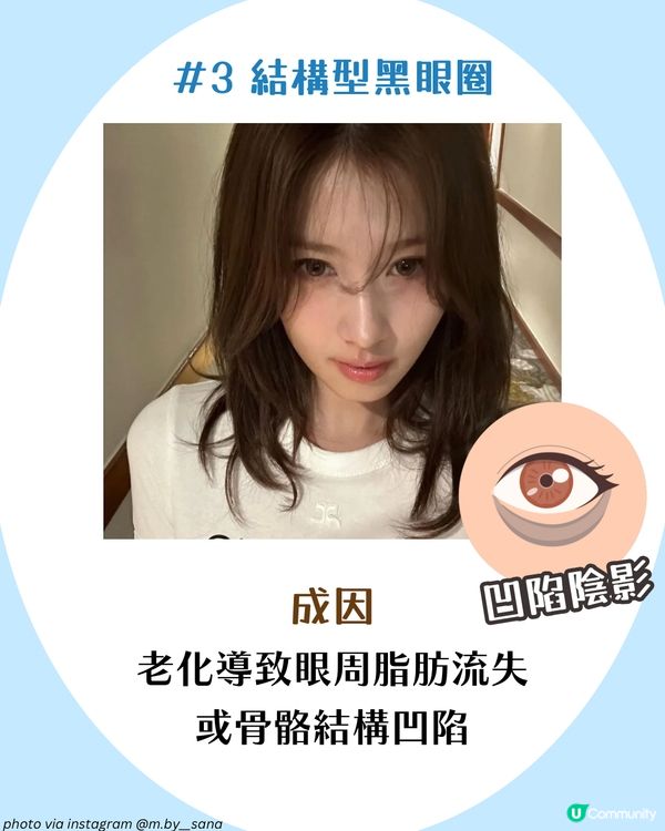 3大必學好習慣改善黑眼圈+好用眼霜推薦🫵🏻 附黑眼圈類型檢測