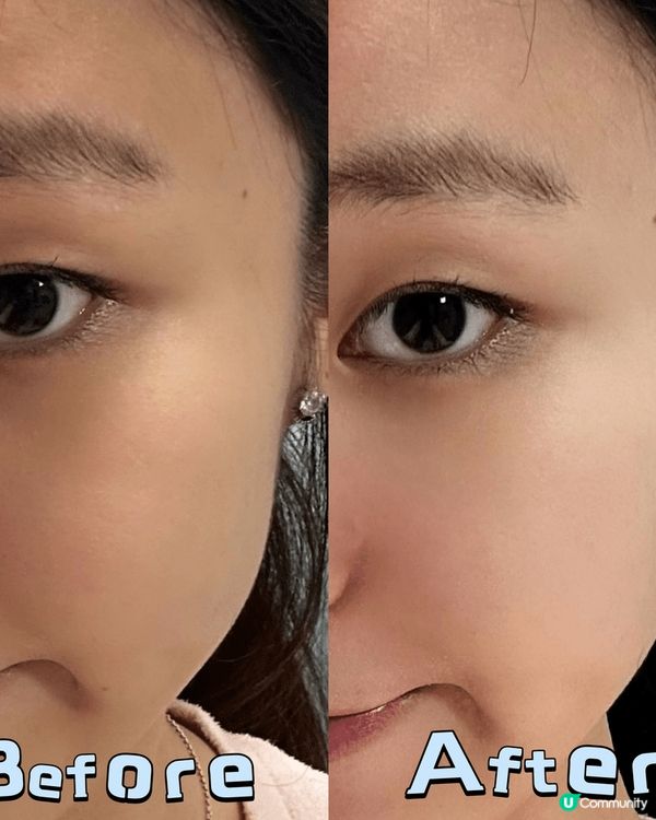 之前朋友推薦我用Bicelle B5 Gel 保濕精華，萬寧...