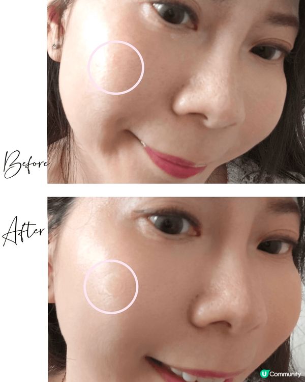 間唔中會生痘痘，有時影相或者出Event☺️有痘痘的話～個妝...