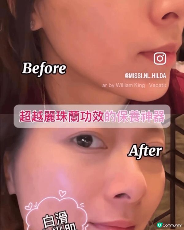 呢款多位美容達人明星一致推薦既家用LED護膚面膜儀——Uli...