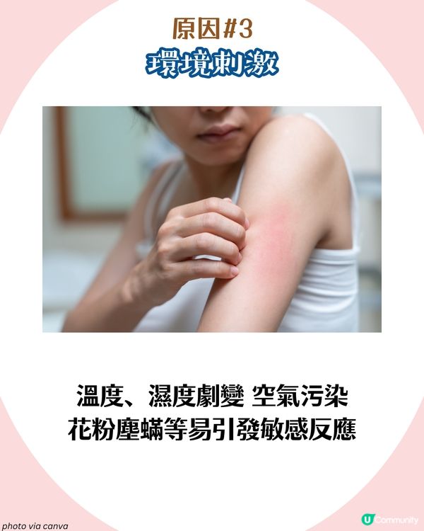 敏感肌自救指南！🍂7大轉季皮膚敏感成因及對策 附好物推介