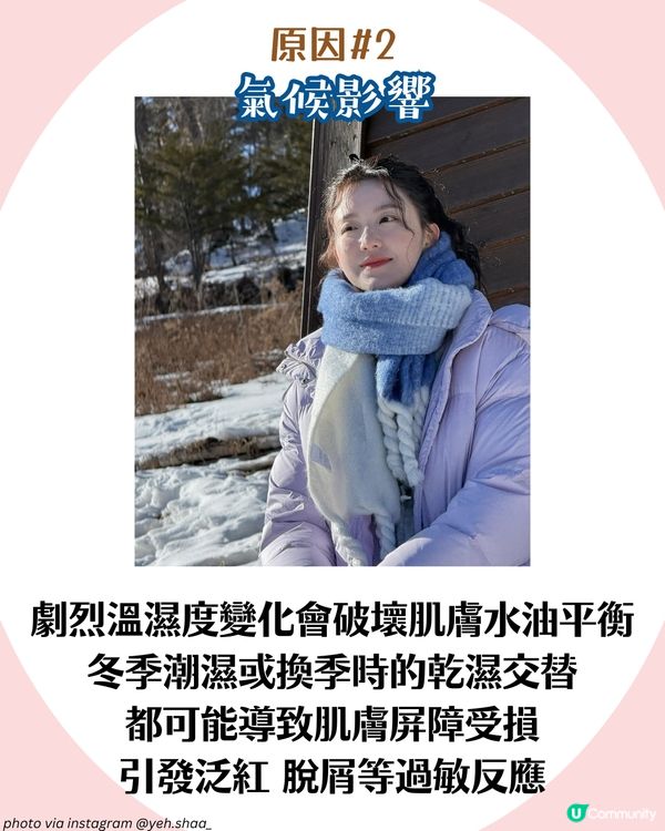 敏感肌自救指南！🍂7大轉季皮膚敏感成因及對策 附好物推介