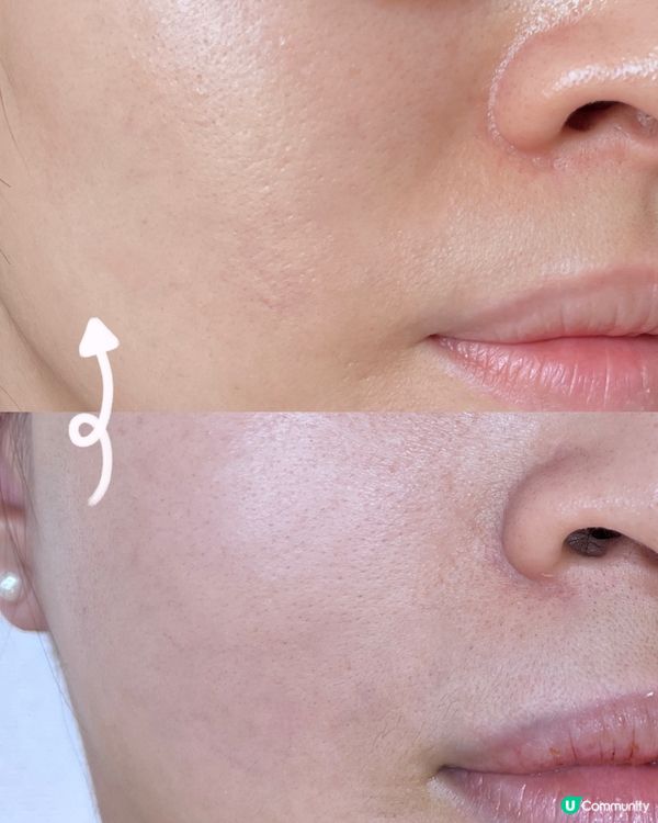 淡紋好幫手！Timeless 抗皺提拉重點精華