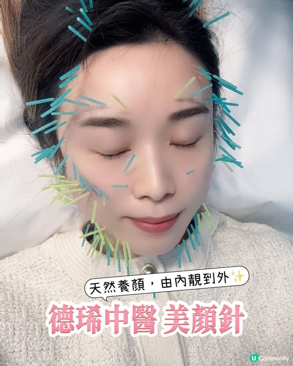 銅鑼灣德琋美顏針 ✨  陳安琪醫師幫你由內靚到外！