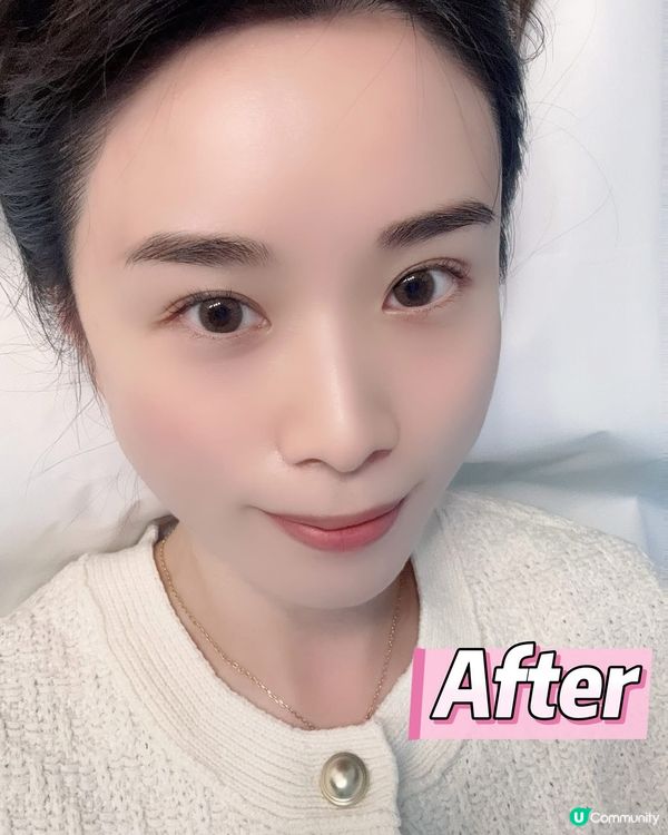 銅鑼灣德琋美顏針 ✨  陳安琪醫師幫你由內靚到外！