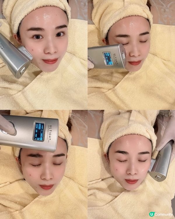 😴 瞓足8個鐘都唔夠？眼袋黑眼圈救星！🔥