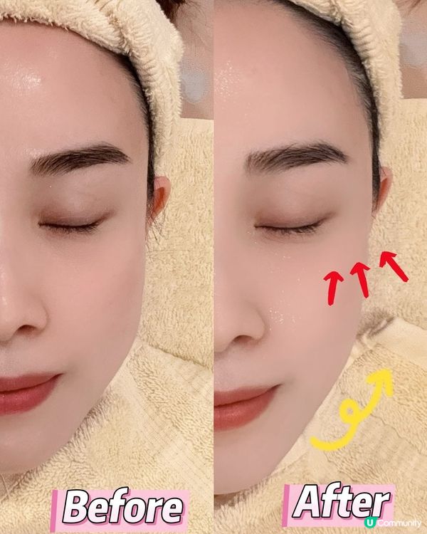 😴 瞓足8個鐘都唔夠？眼袋黑眼圈救星！🔥