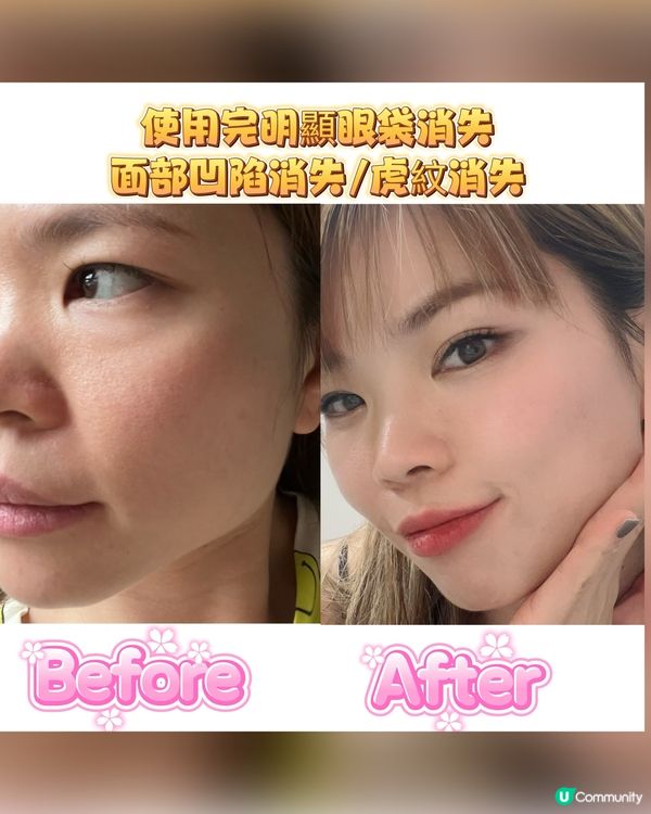 韓國護膚品改善凹凸嵌面