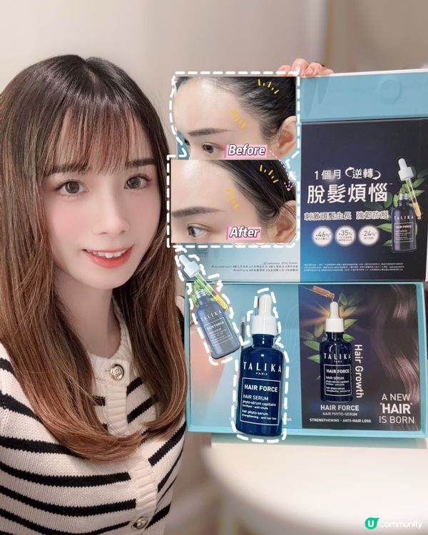## 1個月頭髮急急長🤩  
## 3重強韌防脫髮精華💪