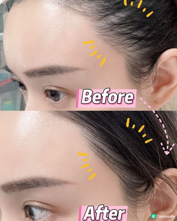 ## 1個月頭髮急急長🤩  
## 3重強韌防脫髮精華💪