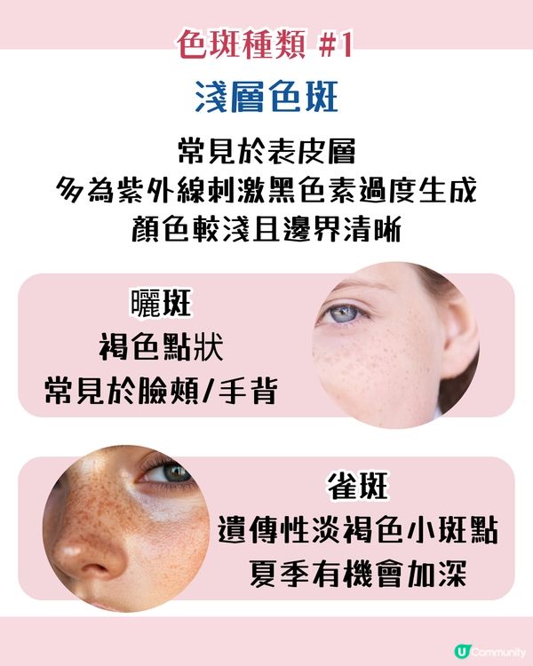 【色斑預防攻略】6個習慣令斑點不再來！6大成因☀️4類人容易長斑！