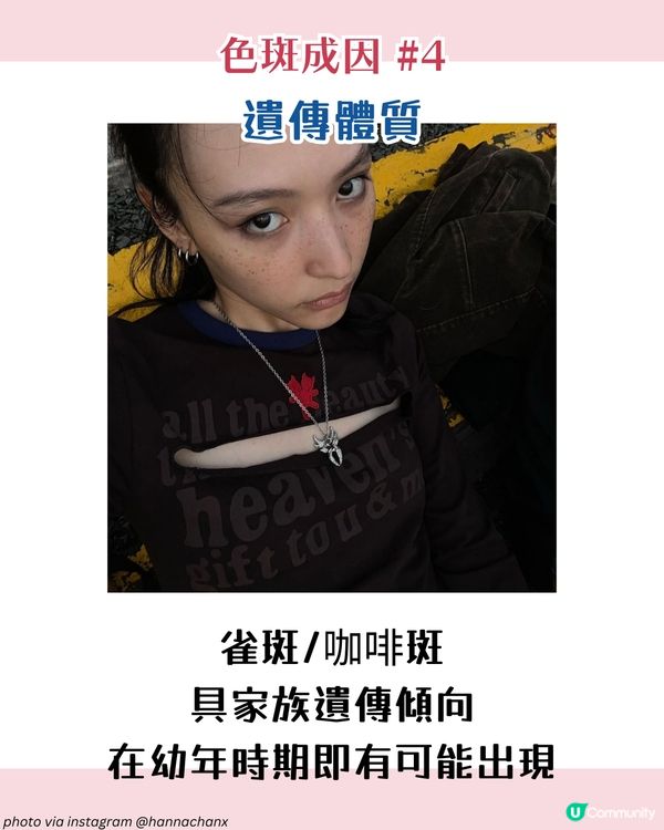 【色斑預防攻略】6個習慣令斑點不再來！6大成因☀️4類人容易長斑！