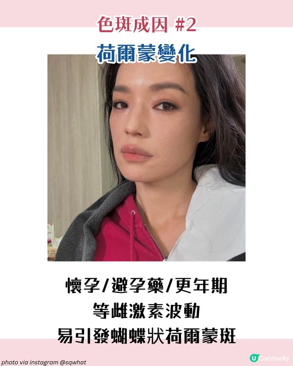 【色斑預防攻略】6個習慣令斑點不再來！6大成因☀️4類人容易長斑！