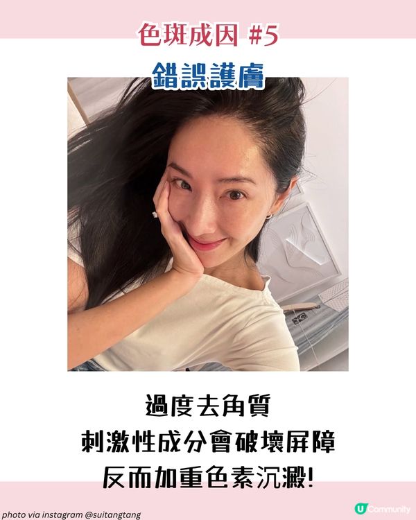 【色斑預防攻略】6個習慣令斑點不再來！6大成因☀️4類人容易長斑！