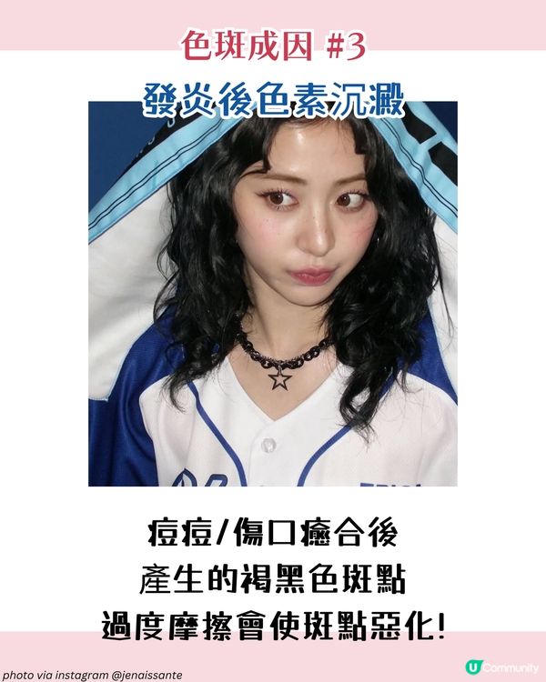 【色斑預防攻略】6個習慣令斑點不再來！6大成因☀️4類人容易長斑！