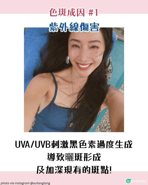 【色斑預防攻略】6個習慣令斑點不再來！6大成因☀️4類人容易長斑！